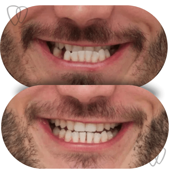 AD03